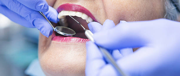 Best Emergency Denture Repair in Fairfield, OH